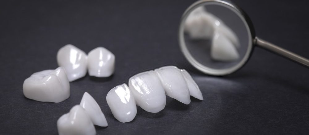 تلبيس الأسنان في تركيا التكلفة الاجراء والمميزات والعيوب تركي ويز