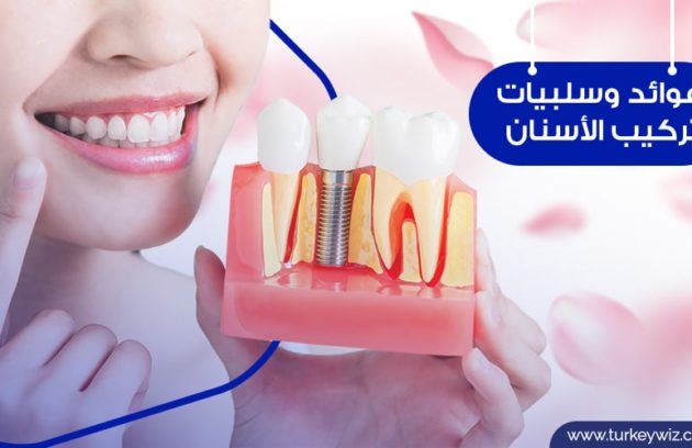 أنواع تركيب الأسنان المختلفة